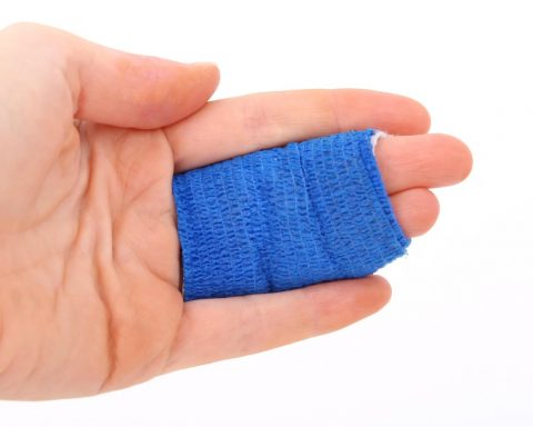 Persoon met littekens op de arm in gesprek met een begeleider